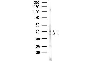 Western blot analysis of lysates from Rat testis, using Hsp40 Antibody at 1/1000 dilution.