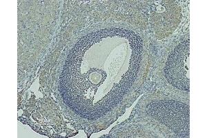 Expression of GnRHR in rat ovary - Immunohistochemical staining of rat ovary paraffin-embedded sections using Anti-GnRH Receptor (extracellular) Antibody (ABIN7043262 and ABIN7044416). (GNRHR 抗体  (Extracellular))