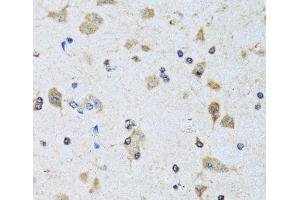Immunohistochemistry of paraffin-embedded Rat brain using PDP1 Polyclonal Antibody at dilution of 1:100 (40x lens). (PDP 抗体)