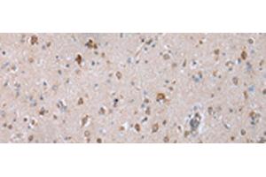 Immunohistochemistry of paraffin-embedded Human brain tissue using COX7C Polyclonal Antibody at dilution of 1:40(x200) (COX7C 抗体)