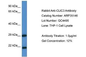 WB Suggested Anti-CLIC3 Antibody   Titration: 1. (CLIC3 抗体  (N-Term))