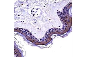 NCK2 Antibody (N-term) ((ABIN658028 and ABIN2846966))immunohistochemistry analysis in formalin fixed and paraffin embedded human skin tissue followed by peroxidase conjugation of the secondary antibody and DAB staining. (NCK2 抗体  (N-Term))