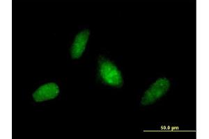 Immunofluorescence of purified MaxPab antibody to ZNF313 on HeLa cell. (RNF114 抗体  (AA 1-228))