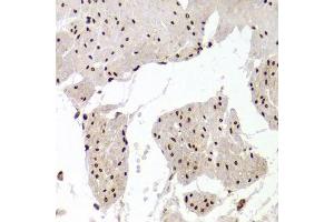 Immunohistochemistry of paraffin-embedded human stomach using XRCC6 Antibody.