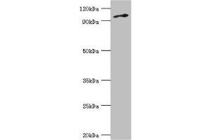 Western blot All lanes: DNA replication licensing factor MCM6 antibody at 3 μg/mL + Jurkat whole cell lysate Secondary Goat polyclonal to rabbit IgG at 1/10000 dilution Predicted band size: 93 kDa Observed band size: 93 kDa (MCM6 抗体  (AA 562-821))