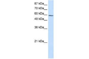 WB Suggested Anti-TP73 Antibody Titration:  2. (Tumor Protein p73 抗体  (N-Term))