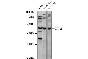 Western blot analysis of extracts of various cell lines, using C3 antibody (ABIN6131229, ABIN6137771, ABIN6137772 and ABIN6221976) at 1:1000 dilution.