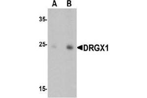 Western blot analysis of DRGX in rat liver tissue lysate with DRGX Antibody  at (A) 1 and (B) 2 ug/mL. (DRGX 抗体  (C-Term))