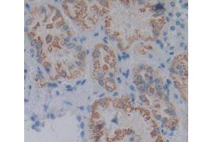 Used in DAB staining on fromalin fixed paraffin- embedded kidney tissue (ACP6 抗体  (AA 1-428))