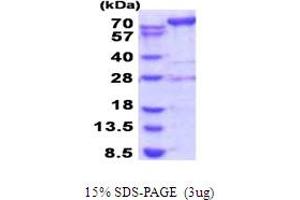 SDS-PAGE (SDS) image for Adenosine Monophosphate Deaminase 2 (AMPD2) (AA 236-879) protein (His tag) (ABIN6387507) (AMPD2 Protein (AA 236-879) (His tag))