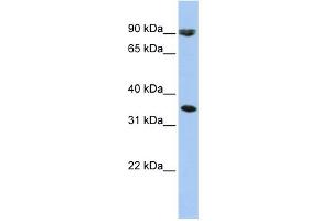 WB Suggested Anti-SLC10A7 Antibody Titration:  0. (SLC10A7 抗体  (Middle Region))