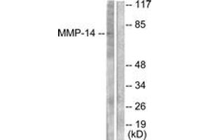 Western blot analysis of extracts from NIH-3T3 cells, using MMP-14 Antibody. (MMP14 抗体  (AA 471-520))