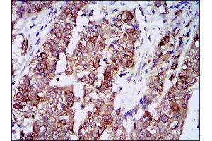 Immunohistochemistry (IHC) image for anti-Heat Shock Protein 90kDa alpha (Cytosolic), Class A Member 1 (HSP90AA1) antibody (ABIN1843961)