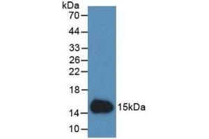 Detection of Recombinant Cys-c, Human using Monoclonal Antibody to Cystatin C (Cys-C) (CST3 抗体  (AA 27-146))