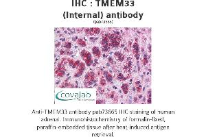 Image no. 1 for anti-Transmembrane Protein 33 (TMEM33) (Internal Region) antibody (ABIN1740155) (TMEM33 抗体  (Internal Region))