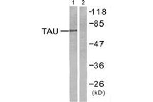 Western blot analysis of extracts from mouse brain cells, using Tau (Ab-212) Antibody. (tau 抗体  (AA 496-545))