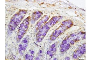 Immunohistochemistry (Paraffin-embedded Sections) (IHC (p)) image for anti-Drought-Repressed 4 Protein (DR4) (AA 401-468) antibody (ABIN670581)