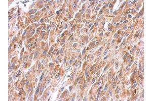 IHC-P Image NDUFS8 antibody detects NDUFS8 protein at cytosol on U87 xenograft by immunohistochemical analysis.