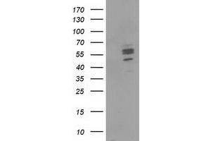 Image no. 1 for anti-Carnosine Dipeptidase 1 (Metallopeptidase M20 Family) (CNDP1) antibody (ABIN1497547) (CNDP1 抗体)