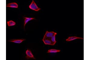 ABIN6261368 and ABIN6273232 staining Hela by IF/ICC. (DBN1 抗体  (Internal Region))
