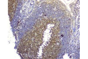 IHC analysis of SQSTM1 using anti-SQSTM1 antibody (ABIN3043937).