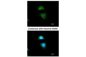 ICC/IF Image Immunofluorescence analysis of methanol-fixed HeLa, using Cytochrome P450 Reductase, antibody at 1:200 dilution. (POR 抗体  (N-Term))