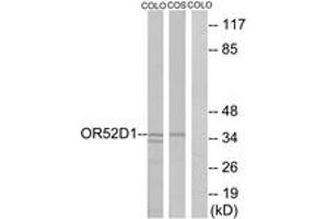 Western Blotting (WB) image for anti-Olfactory Receptor, Family 52, Subfamily D, Member 1 (OR52D1) (AA 269-318) antibody (ABIN2890937) (OR52D1 抗体  (AA 269-318))