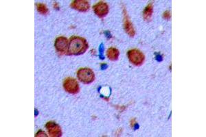 Immunohistochemical analysis of Cadherin 19 staining in human brain formalin fixed paraffin embedded tissue section. (CDH19 抗体  (Center))