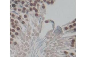 IHC-P analysis of Kidney tissue, with DAB staining. (FOXM1 抗体  (AA 209-460))