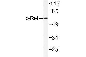 Image no. 1 for anti-REL proto-oncogene (c-Rel) antibody (ABIN271805) (c-Rel 抗体)