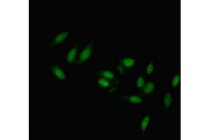Immunofluorescent analysis of Hela cells using ABIN7173229 at dilution of 1:100 and Alexa Fluor 488-congugated AffiniPure Goat Anti-Rabbit IgG(H+L) (Transmembrane Protein 47 (TMEM47) (AA 42-82) 抗体)