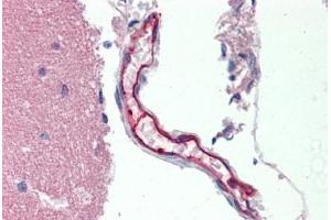 Human Vessel: Formalin-Fixed, Paraffin-Embedded (FFPE)