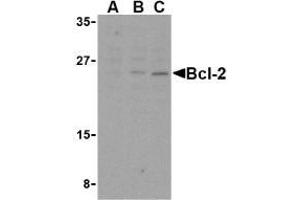 Western blot analysis of Bcl-2 in A-20 cell lysates with AP30129PU-N Bcl-2 antibody at (A) 1, (B) 2, and (C) 4 μg/ml. (Bcl-2 抗体  (Intermediate Domain))