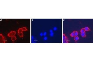 Expression of nAChR β4 in human SH-SY5Y cellsCell surface detection of nAChR β4 in live intact human SH-SY5Y neuroblastoma cells.