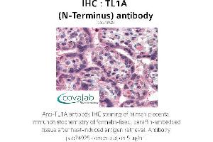 Image no. 1 for anti-Tumor Necrosis Factor (Ligand) Superfamily, Member 15 (TNFSF15) antibody (ABIN1740101) (TNFSF15 抗体)