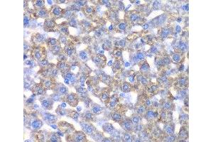 Immunohistochemistry of paraffin-embedded Mouse liver using CCBL1 Polyclonal Antibody at dilution of 1:100 (40x lens). (CCBL1 抗体)