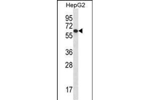 TBC1D22A Antibody (C-term) (ABIN656780 and ABIN2845998) western blot analysis in HepG2 cell line lysates (35 μg/lane). (TBC1D22A 抗体  (C-Term))
