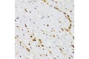 Immunohistochemistry of paraffin-embedded human stomach using RAD50 Antibody. (RAD50 抗体)