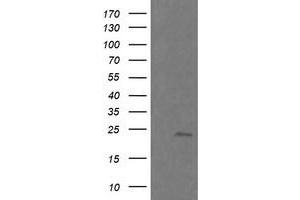 Image no. 3 for anti-RAB21, Member RAS Oncogene Family (RAB21) antibody (ABIN1500545) (RAB21 抗体)