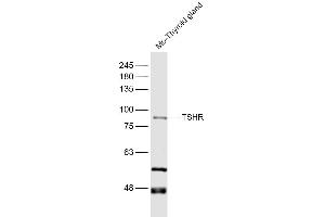 Thyroid gland lysates probed with TSHR Polyclonal Antibody, Unconjugated  at 1:500 dilution and 4˚C overnight incubation.