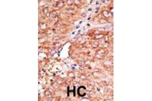 Immunohistochemistry (IHC) image for anti-Chemokine Binding Protein 2 (CCBP2) antibody (ABIN3001324) (CCBP2 抗体)