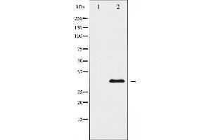 Western blot analysis of hnRNP C1/2 expression in EGF treated HuvEc whole cell lysates,The lane on the left is treated with the antigen-specific peptide. (HNRNPC 抗体  (C-Term))