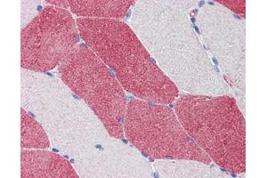 HMGCS1 antibody was used for immunohistochemistry at a concentration of 4-8 ug/ml. (HMGCS1 抗体)
