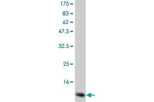 Western Blot detection against Immunogen (14 KDa) . (GM-CSF 抗体)