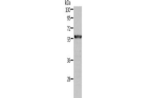 Western Blotting (WB) image for anti-Aldehyde Dehydrogenase 6 Family, Member A1 (ALDH6A1) antibody (ABIN2422525) (ALDH6A1 抗体)