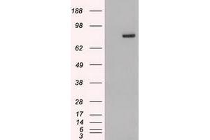 Western Blotting (WB) image for anti-Signal Transducer and Activator of Transcription 4 (STAT4) (AA 633-652) antibody (ABIN1491621) (STAT4 抗体  (AA 633-652))