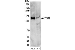 Western Blotting (WB) image for anti-Tuberous Sclerosis 1 (TSC1) (C-Term) antibody (ABIN7449615)