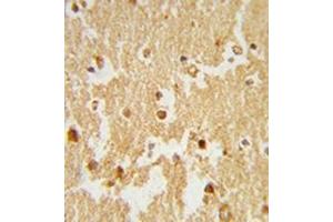 Formalin-fixed and paraffin-embedded human brain tissue reacted with ESRRB Antibody , which was peroxidase-conjugated to the secondary antibody, followed by DAB staining. (ESRRB 抗体  (Middle Region))