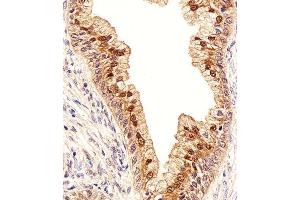 Immunohistochemical analysis of paraffin-embedded H. (IDH1 抗体  (AA 116-143))