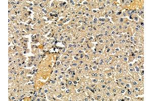 ABIN7095442 and ABIN7099499 at 1/100 staining mouse liver tissue by IHC-P. (HMGCS2 抗体)